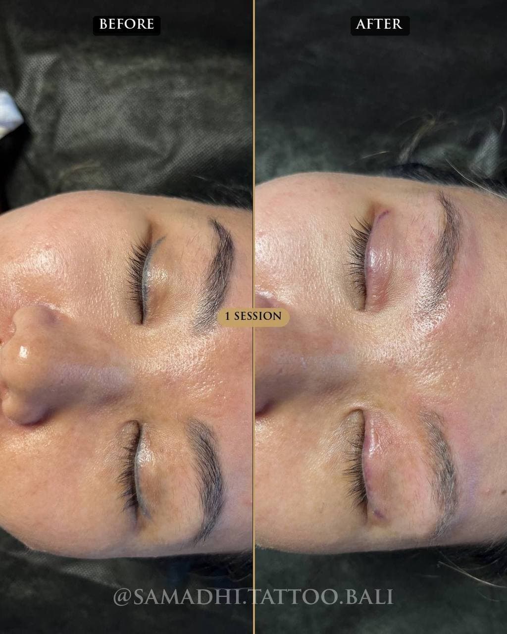 Before and after permanent eyeliner and brow removal — Samadhi Uluwatu Bali